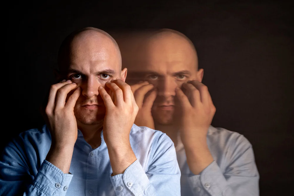 tms for bipolar depression​