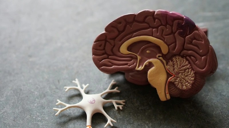 comparison of mert vs tms effect on the brain